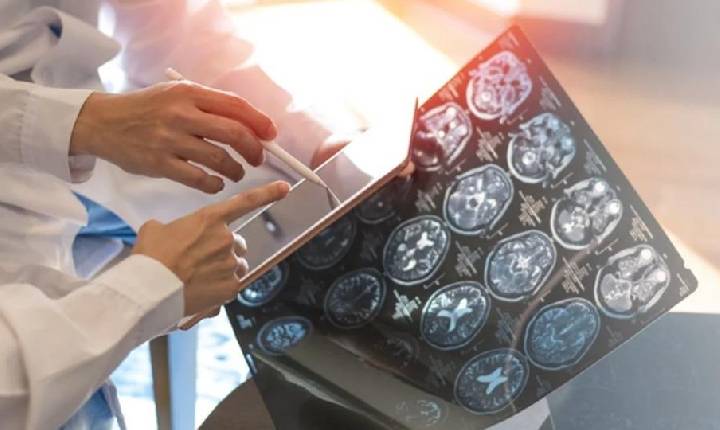 Brasil - SUS disponibiliza nova medicação para paciente com ELA em fase inicial