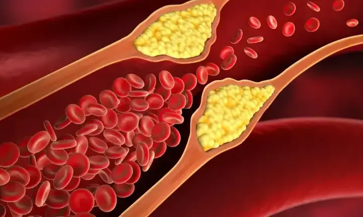 Colesterol alto? Estes alimentos baratos ajudam a reduzir os níveis