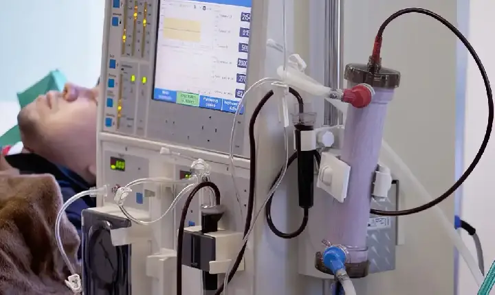 Destaque - Estudo alerta para subdiagnóstico da doença renal crônica no Brasil