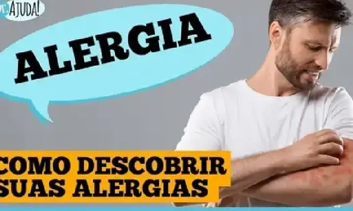 Dr. Ajuda | Saúde -  Conviver com alergia pode ser desgastante, mas muitas vezes, evitável