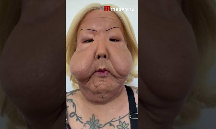 Fábia Oliveira - Veja como está Juju do Pix seis meses depois de cirurgia facial