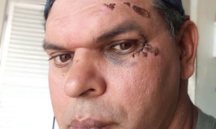 JAILTON DELOGO DENUNCIA, CALÇADAS CONTINUAM SENDO UM GRANDE OBSTÁCULO PARA AS PESSOAS COM DEFICIÊNCIA.