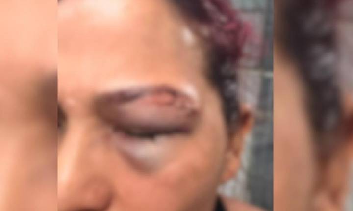 lantão de Polícia-  Mulher denuncia ex-companheiro por agressão física