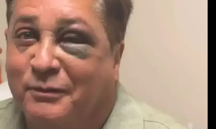 Leonardo revela fratura no rosto após queda em pescaria