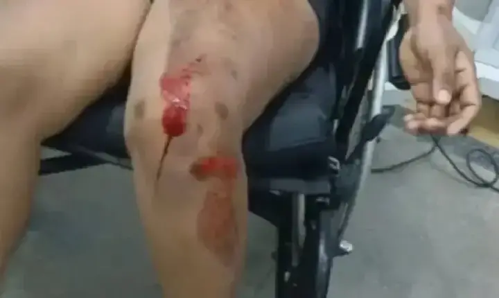 Polícia - Mulher é socorrida após tentativa de automutilação em residência em RO