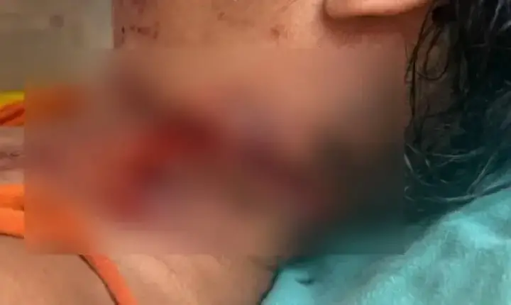 Polícia - Mulher é socorrida com ferimento no pescoço e Polícia Civil investiga o caso em São Francisco do Guaporé