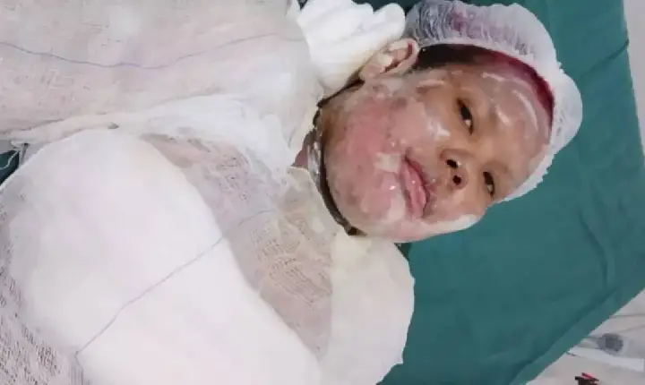 Polícia - Polícia investiga morte suspeita de mulher após queimaduras graves em RO