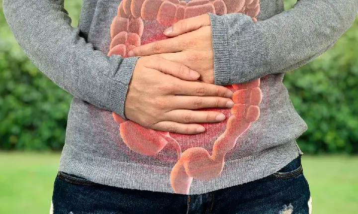 Saúde Câncer de intestino antes dos 50 tem tumor diferente e maior sobrevida
