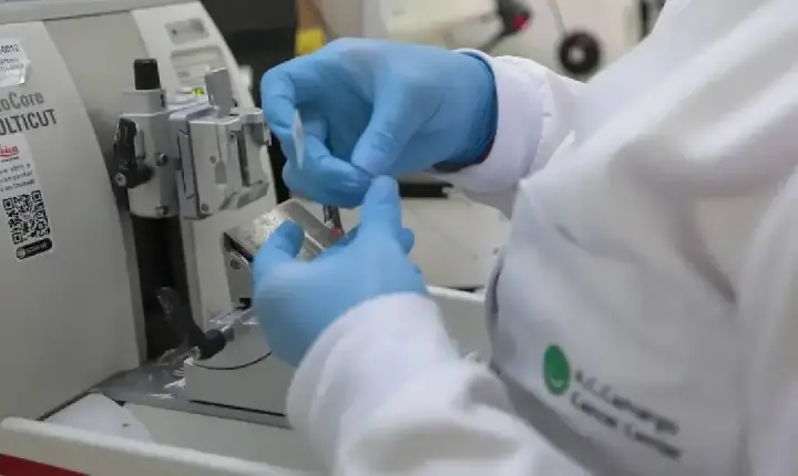 Saúde - SUS incorpora novo tratamento para leucemia mieloide aguda