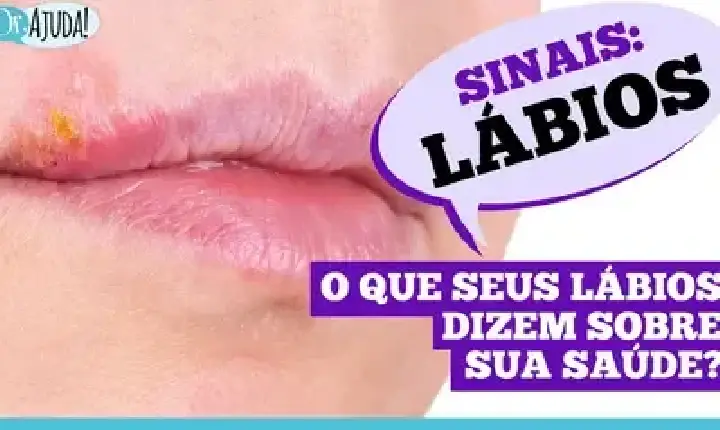 VÉDEOS - Dr. Ajuda | Saúde - Sinais: Lábios