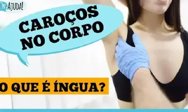 VÍDEO - Dr. Ajuda | Saúde - Íngua no pescoço, axila ou virilha? Entenda o que pode ser