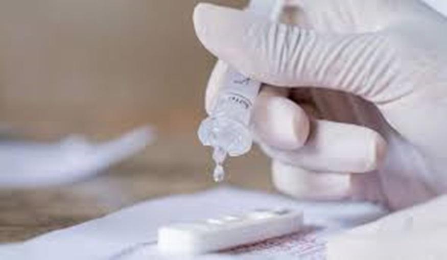Fiocruz alerta para alta de casos de covid-19 em quatro estados