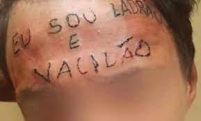 Homem que teve testa tatuada com frase 