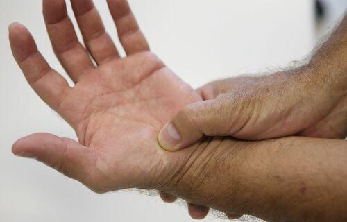 SAÚDE | SAÚDE Muita gente não sabe, mas pode estar com artrose, diz Sociedade Brasileira de Reumatologia