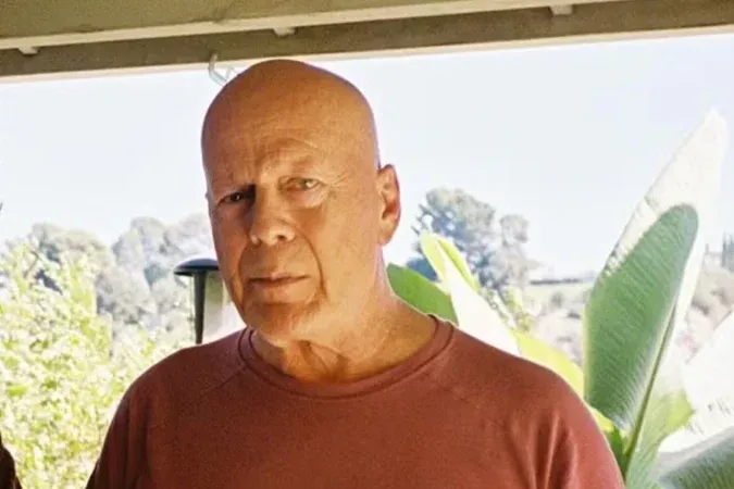 ESTADO DE SAÚDE - Bruce Willis perdeu habilidades de fala, revela esposa