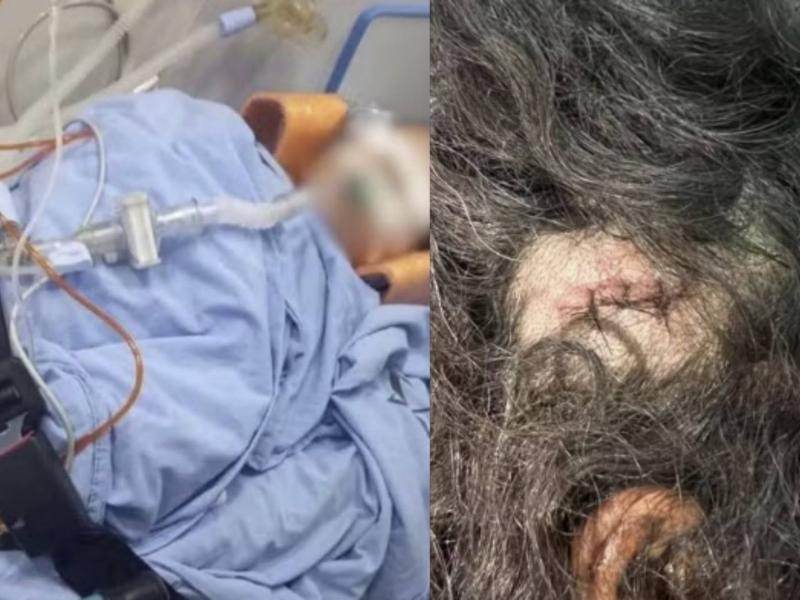 CONFLITO FAMILIAR - Homem é preso suspeito de tentar matar enteado de 3 anos; criança sofreu traumatismo craniano e está em estado grave