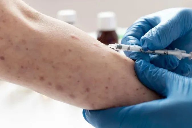 PESQUISA - Sífilis inicial pode ser curada com apenas uma dose de penicilina, mostra estudo