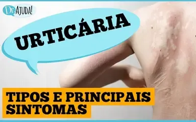 Dr. Ajuda | Saúde Manchas vermelhas na pele: pode ser URTICÁRIA?