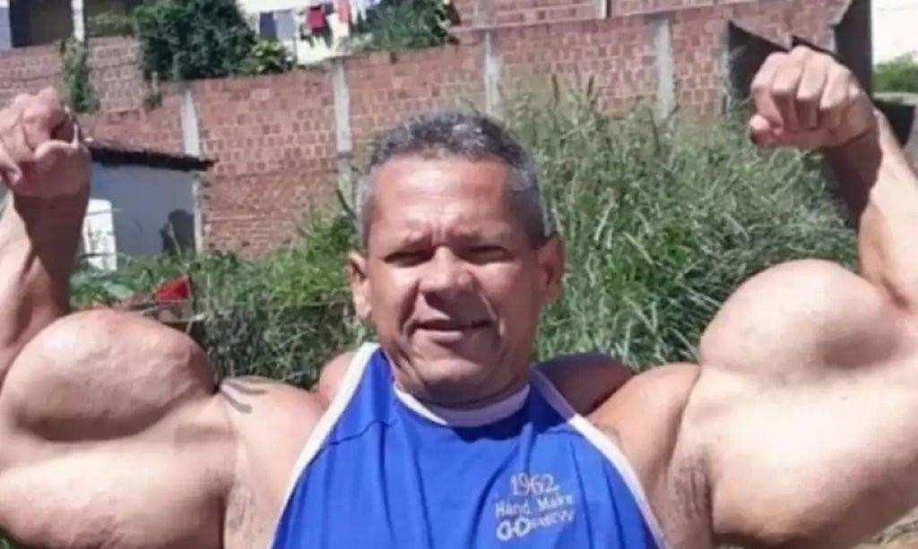 POPEYE BRASILEIRO - Morre Arlindo de Souza, conhecido como 