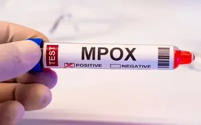 Brasil | Mpox - Mpox: Brasil registra 88 casos em seis estados e no DF em 2026; saiba mais sobre a doença