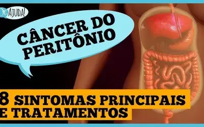 Dr. Ajuda | Saúde - Câncer de peritônio: diagnóstico, tratamento e prognóstico