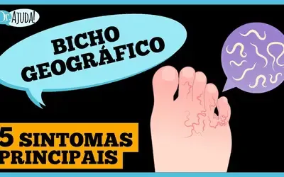 Dr. Ajuda | Saúde-  Coceira intensa nos pés ou nádegas? Pode ser bicho geográfico