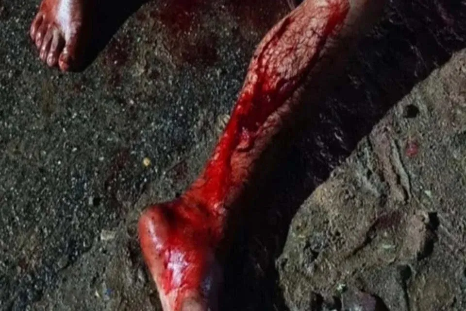 Violência - Briga em bar deixa um morto e outro gravemente ferido em Ji-Paraná