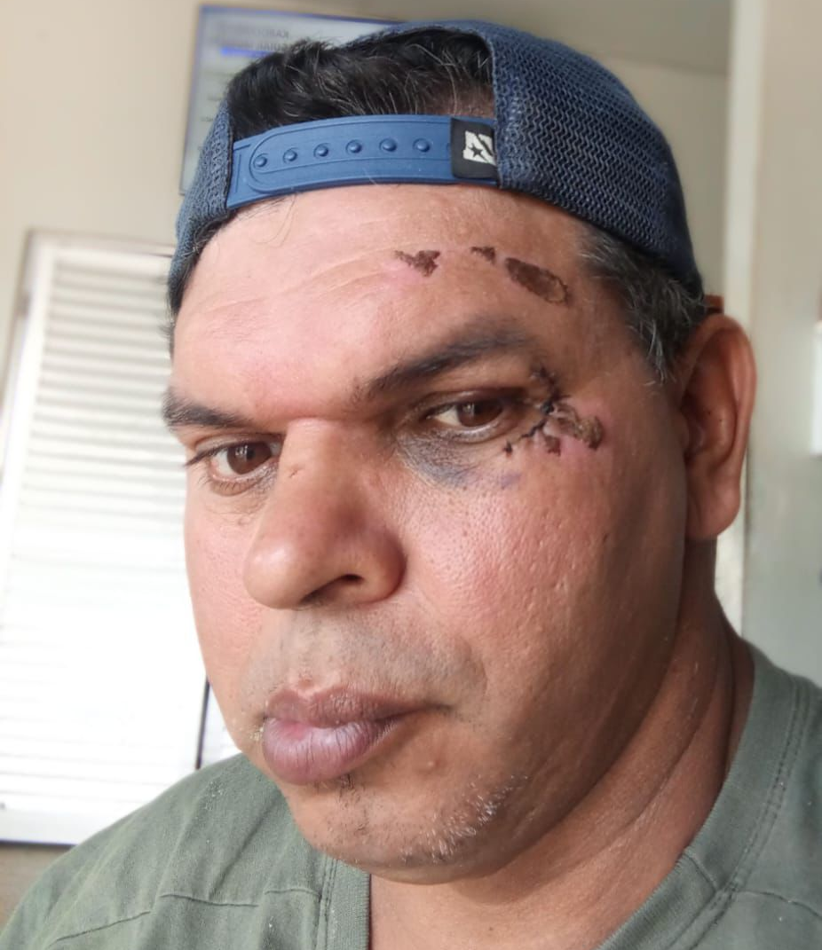 JAILTON DELOGO DENUNCIA, CALÇADAS CONTINUAM SENDO UM GRANDE OBSTÁCULO PARA AS PESSOAS COM DEFICIÊNCIA.