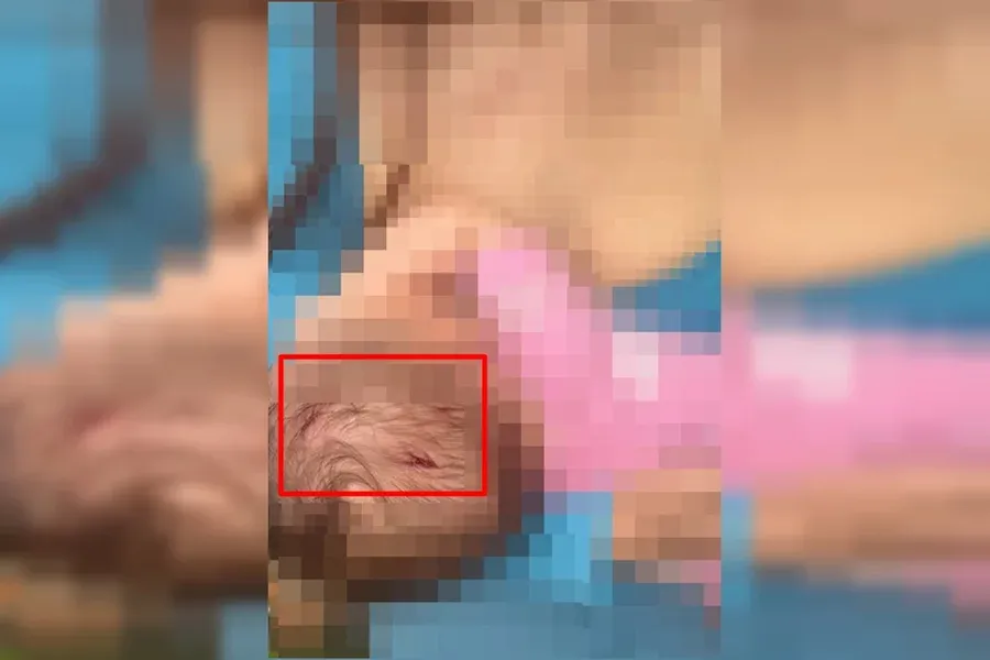 Na Mira - Homem tenta agredir namorada e fura cabeça da filha que era amamentada