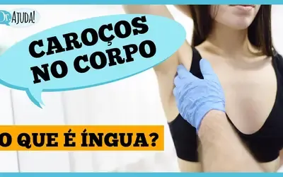 VÍDEO - Dr. Ajuda | Saúde - Íngua no pescoço, axila ou virilha? Entenda o que pode ser