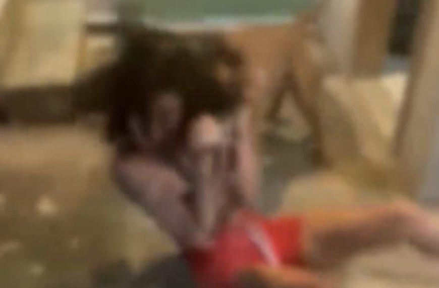 VÍDEO FORTE | Mãe manda pitbull atacar filha após descobrir que ela é do ‘job’; graves ferimentos