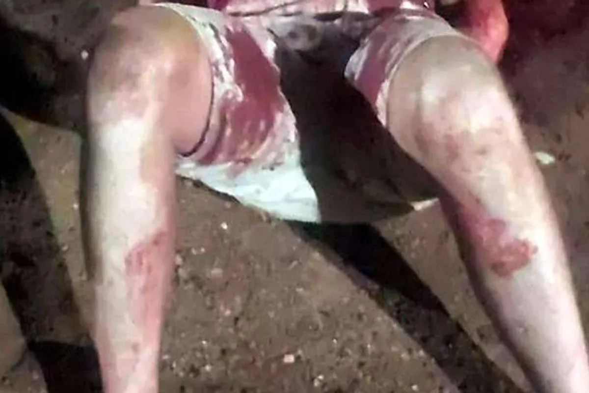 Vilhena - Homem fica com as vísceras expostas após ser esfaqueado no pátio de posto