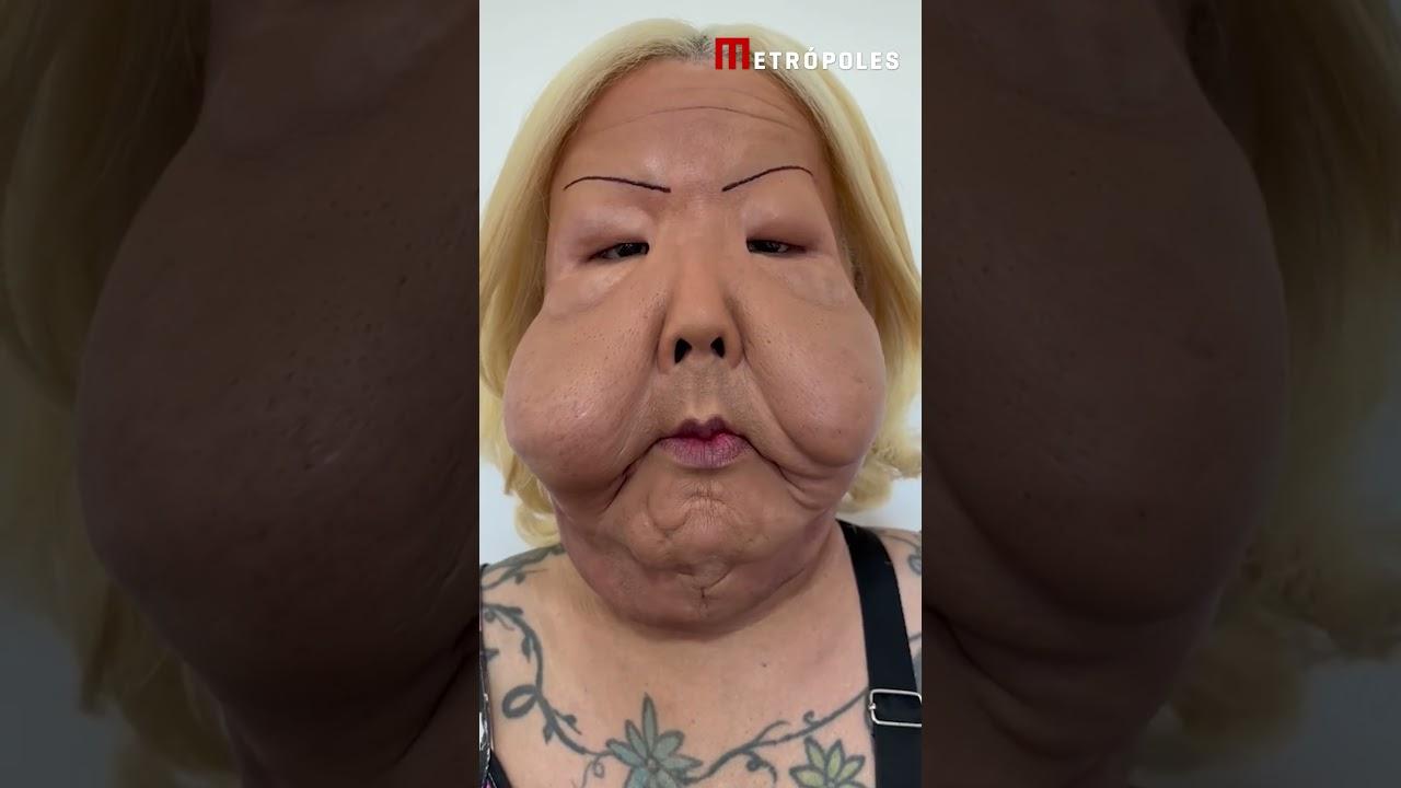 Fábia Oliveira - Veja como está Juju do Pix seis meses depois de cirurgia facial