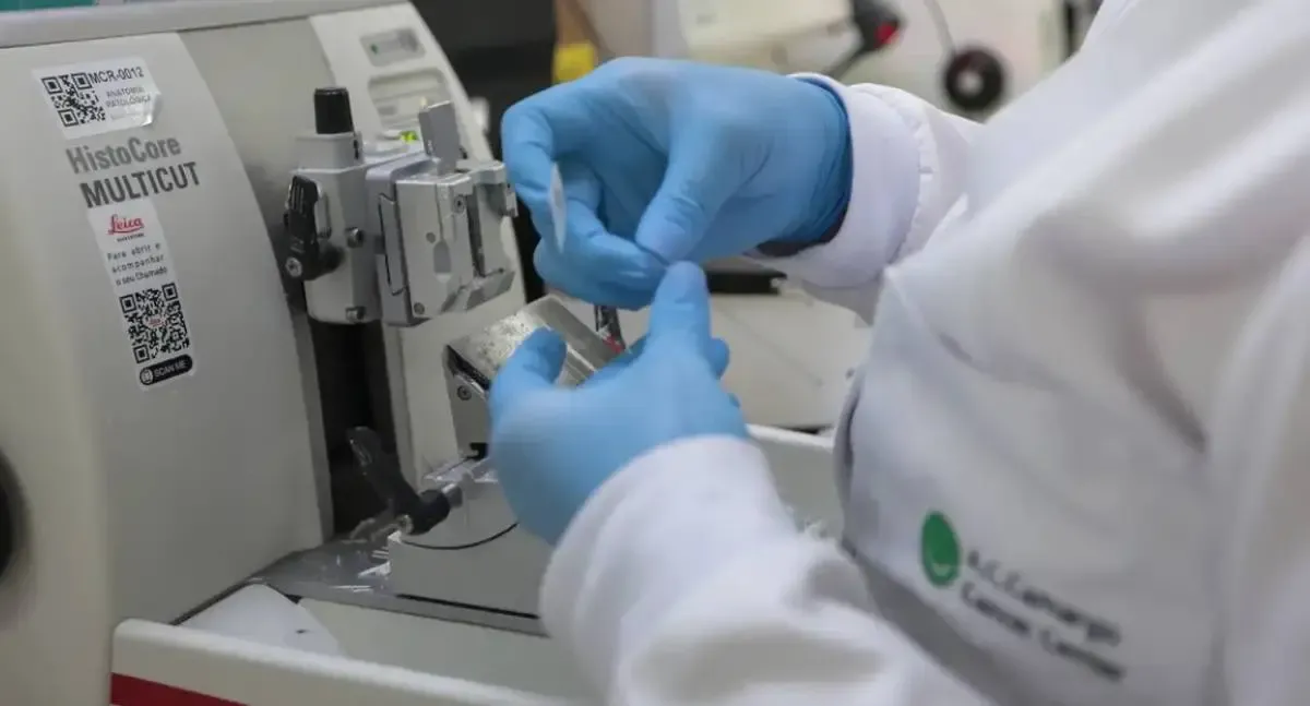 Saúde - SUS incorpora novo tratamento para leucemia mieloide aguda