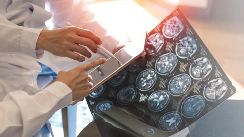 Brasil - SUS disponibiliza nova medicação para paciente com ELA em fase inicial