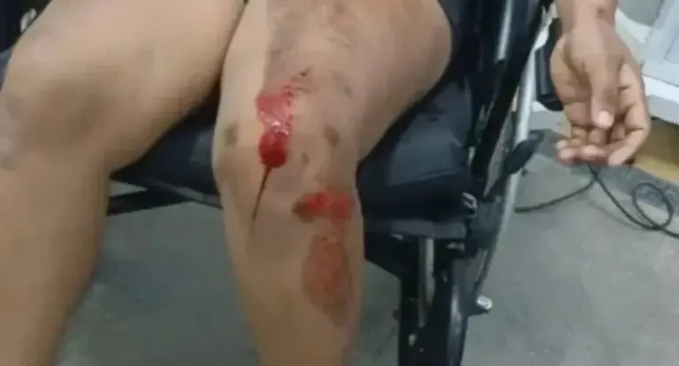 Polícia - Mulher é socorrida após tentativa de automutilação em residência em RO