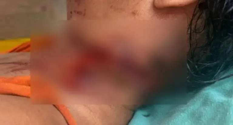 Polícia - Mulher é socorrida com ferimento no pescoço e Polícia Civil investiga o caso em São Francisco do Guaporé