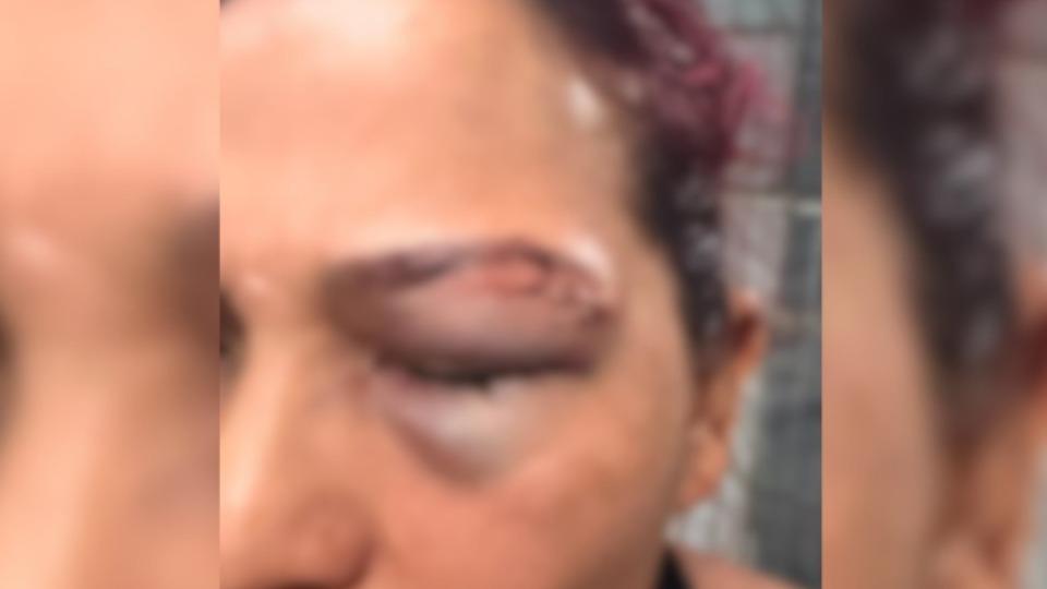 lantão de Polícia-  Mulher denuncia ex-companheiro por agressão física