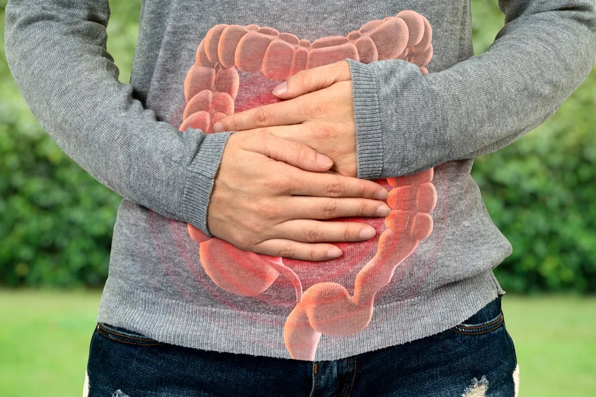 Saúde Câncer de intestino antes dos 50 tem tumor diferente e maior sobrevida